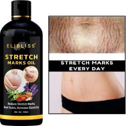 🤩Elibliss Stretch Marks Oil [Buy 1 Get 1 Free]🤩