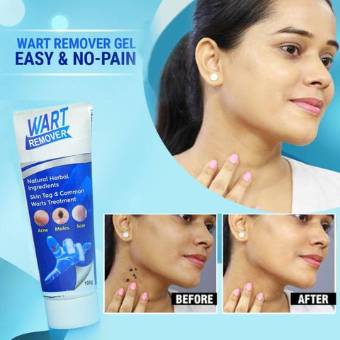 🤩Natural Herbal based Warts Remover Cream [Buy 1 Get 1 free]🤩