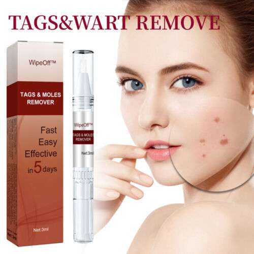 🤩Tags & Moles Remover just in 5 days [Buy 1 Get 1 free]🤩