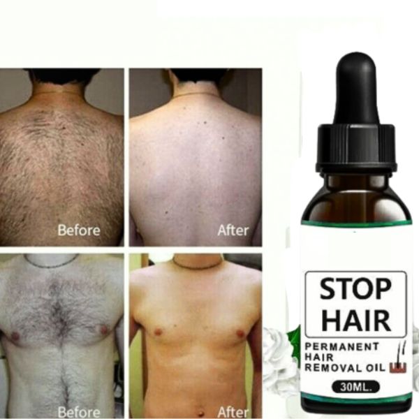 😍VR Group Stop Hair Permanent Hair Removal Oil for Men and Women😍