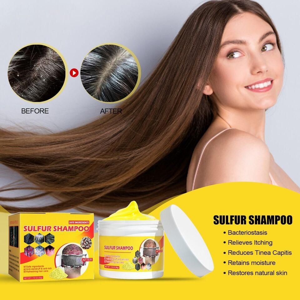 🤩Sulfur Shampoo for Removal of Dandruff and Hair Breakage [Buy 1 Get 1 Free]🤩