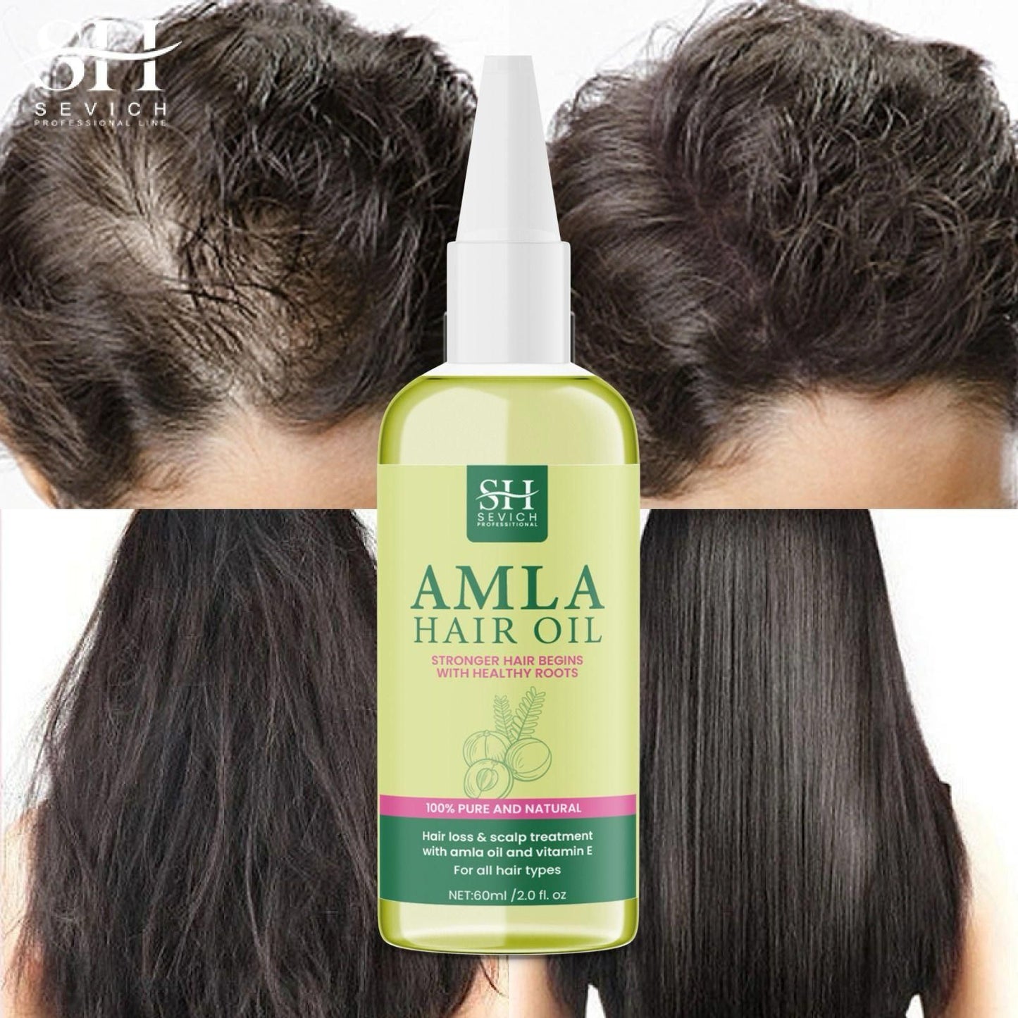 🤩SH Amla Hair Oil - Nourish Your Hair Naturally[Buy 1 Get 1 free]🤩