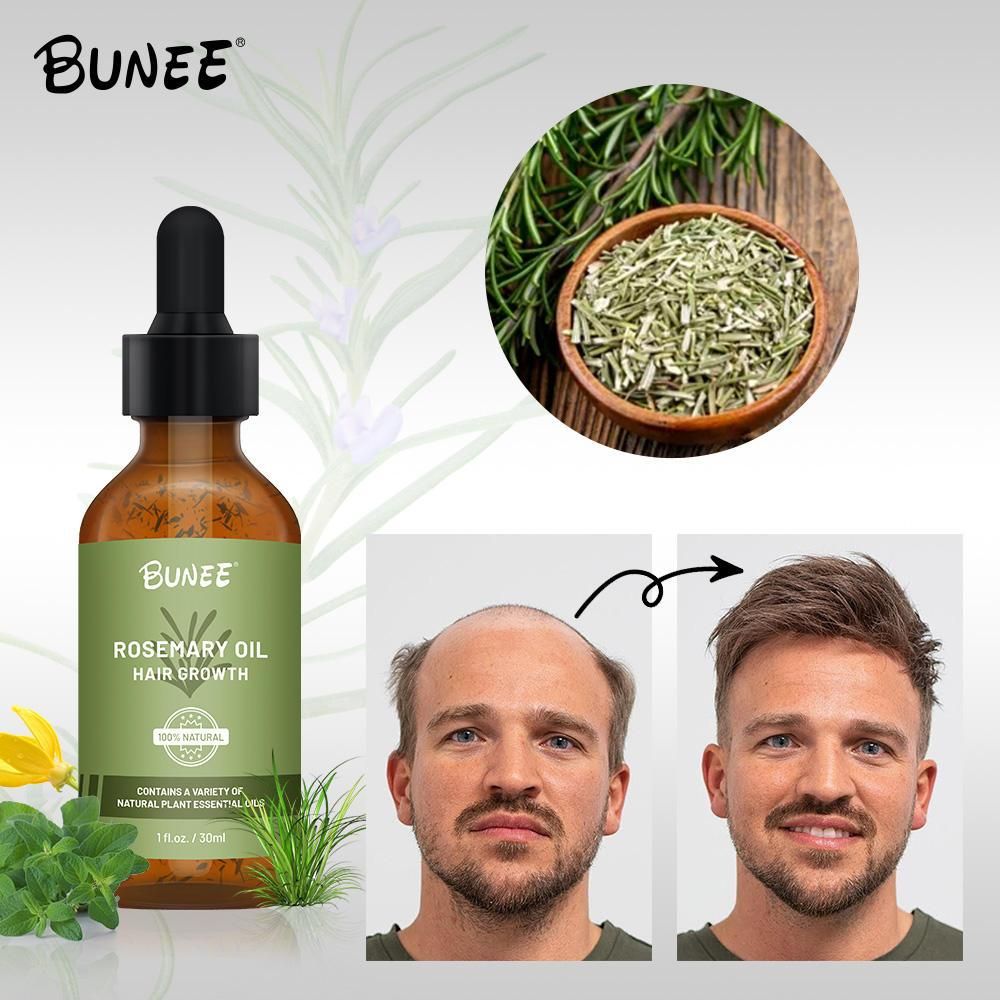 🤩BUNEE Rosemary Hair Growth Serum Oil🤩