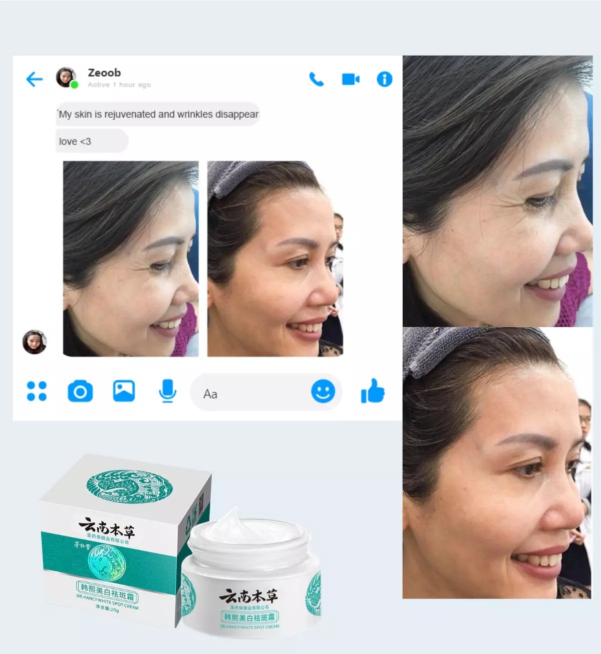 🤩Japanese Melasma Cream [Buy 1 Get 1 Free]🤩