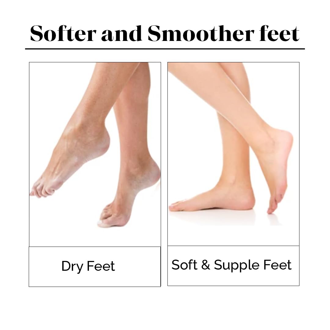 🤩Silicone Gel Heel Socks with Anti Slip for Dry Cracked Feet🤩