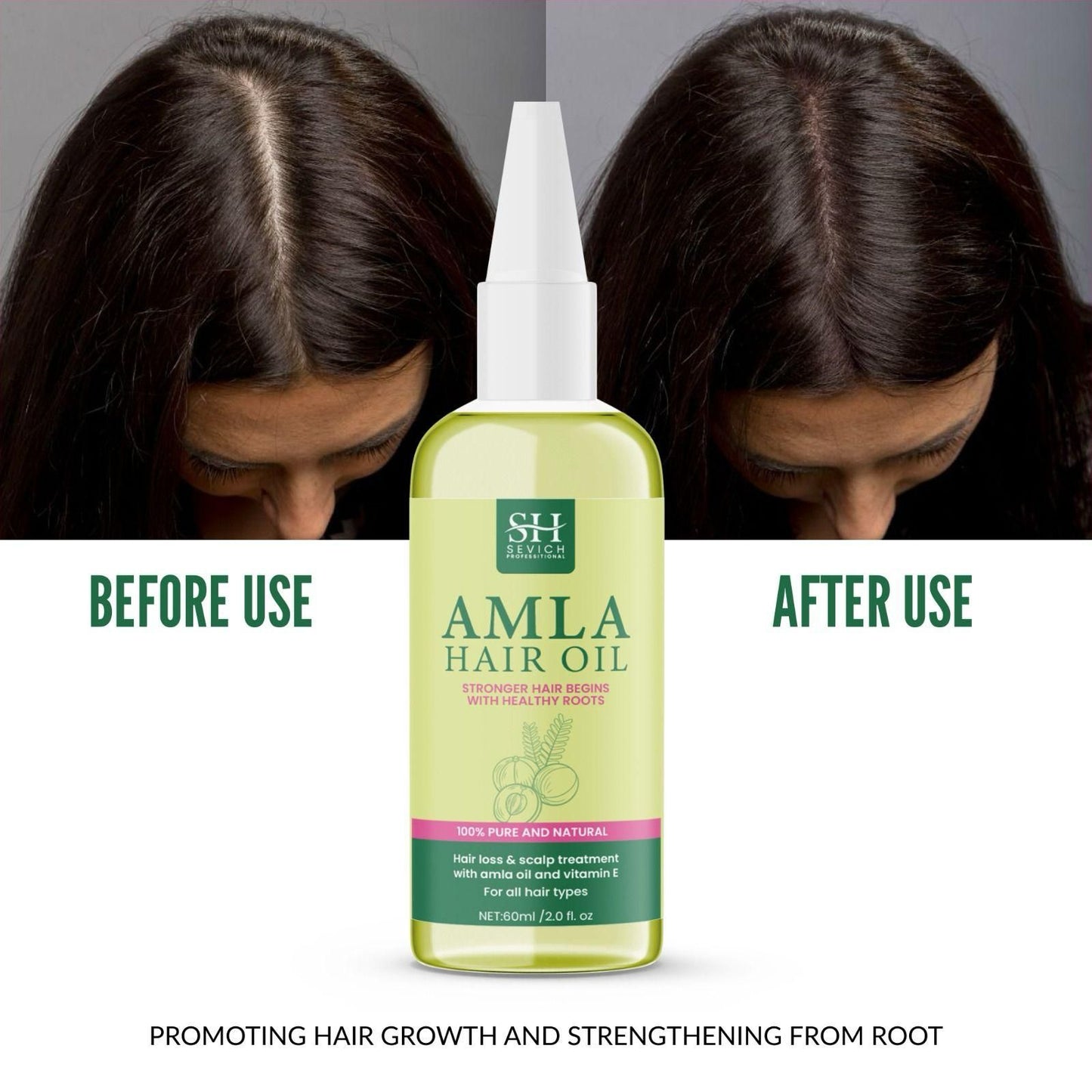 🤩SH Amla Hair Oil - Nourish Your Hair Naturally[Buy 1 Get 1 free]🤩