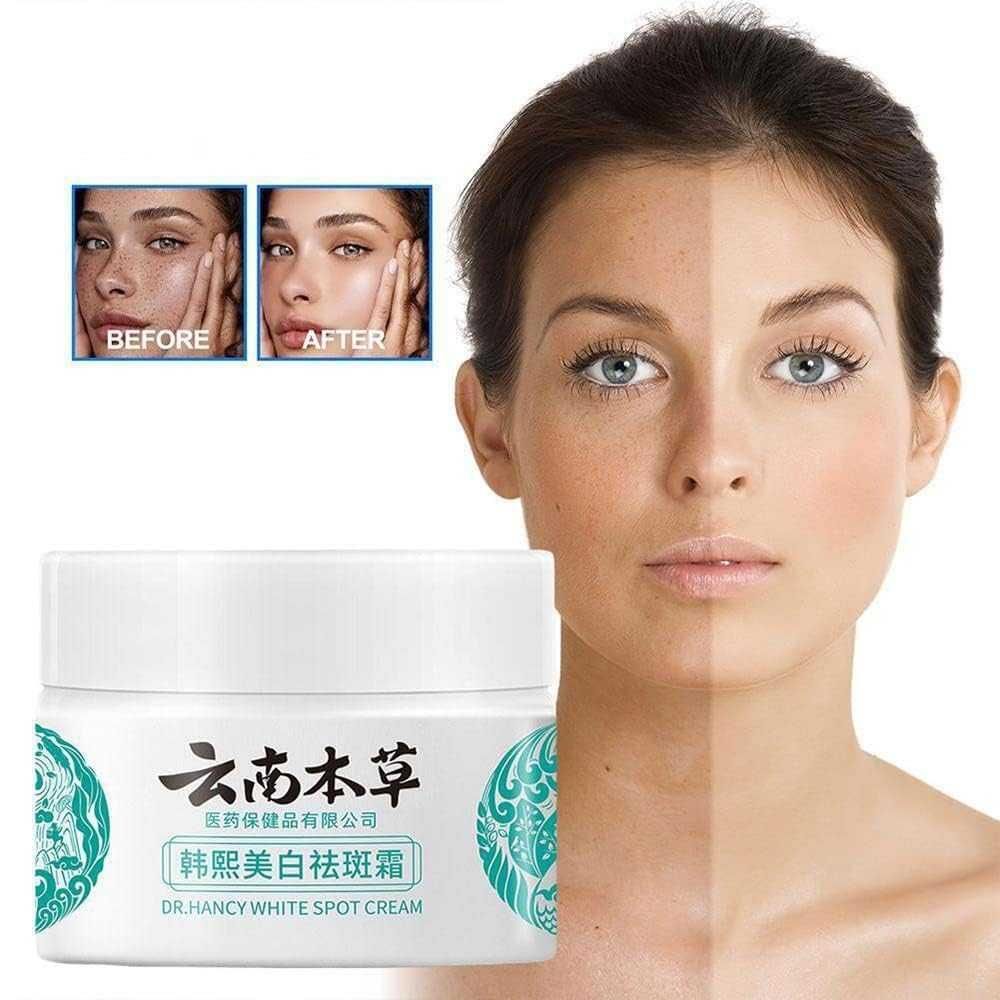 🤩Japanese Melasma Cream [Buy 1 Get 1 Free]🤩