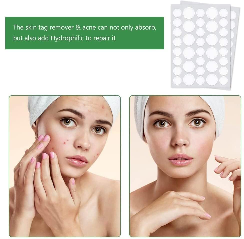 🤩Acne Pimple Patch  Invisible 72 Face Dot Stickers🤩