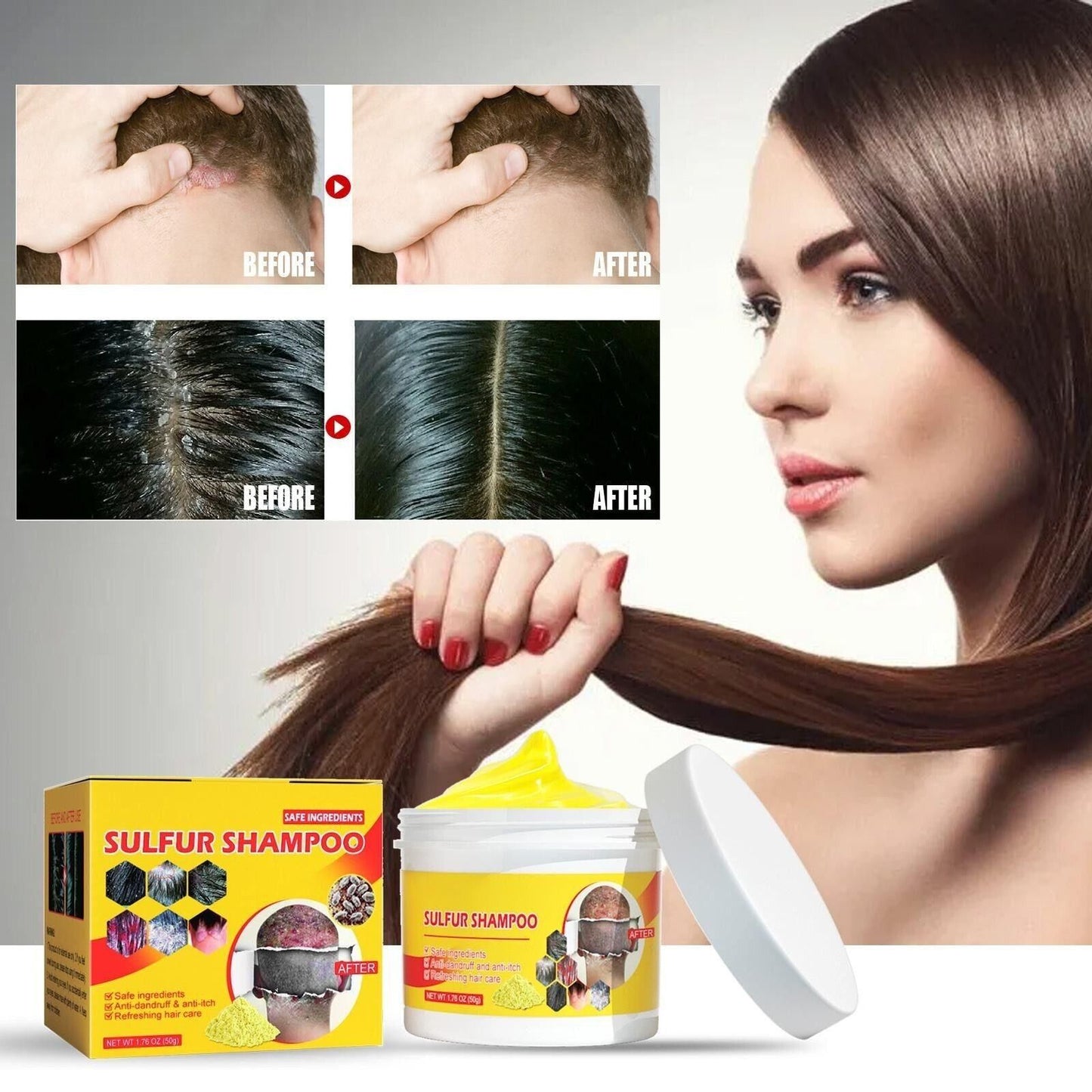 🤩Sulfur Shampoo for Removal of Dandruff and Hair Breakage [Buy 1 Get 1 Free]🤩