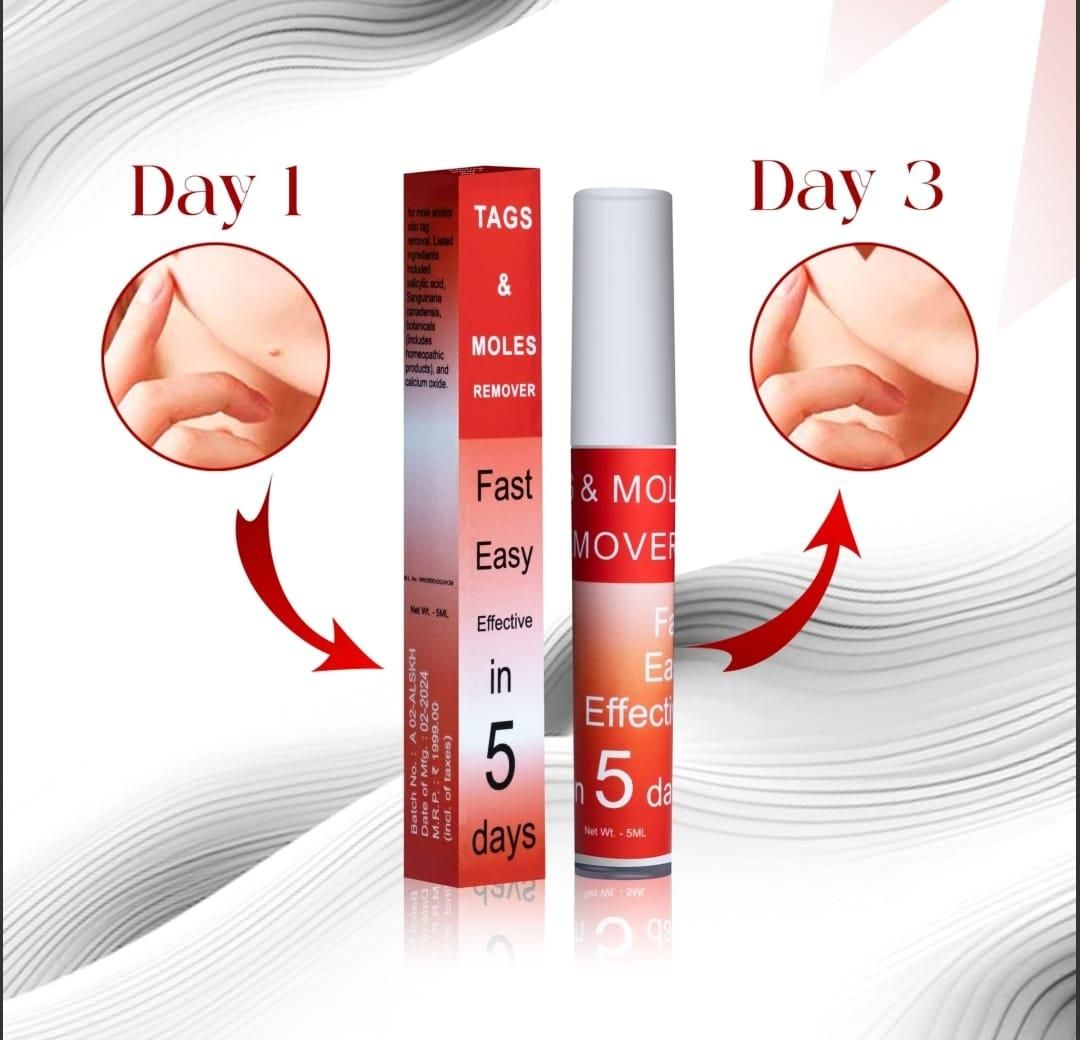 🤩Tags & Moles Remover just in 5 days [Buy 1 Get 1 free]🤩