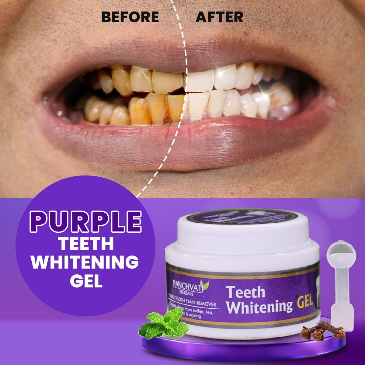 🤩Refreshing Purple Teeth Whitening Gel🤩