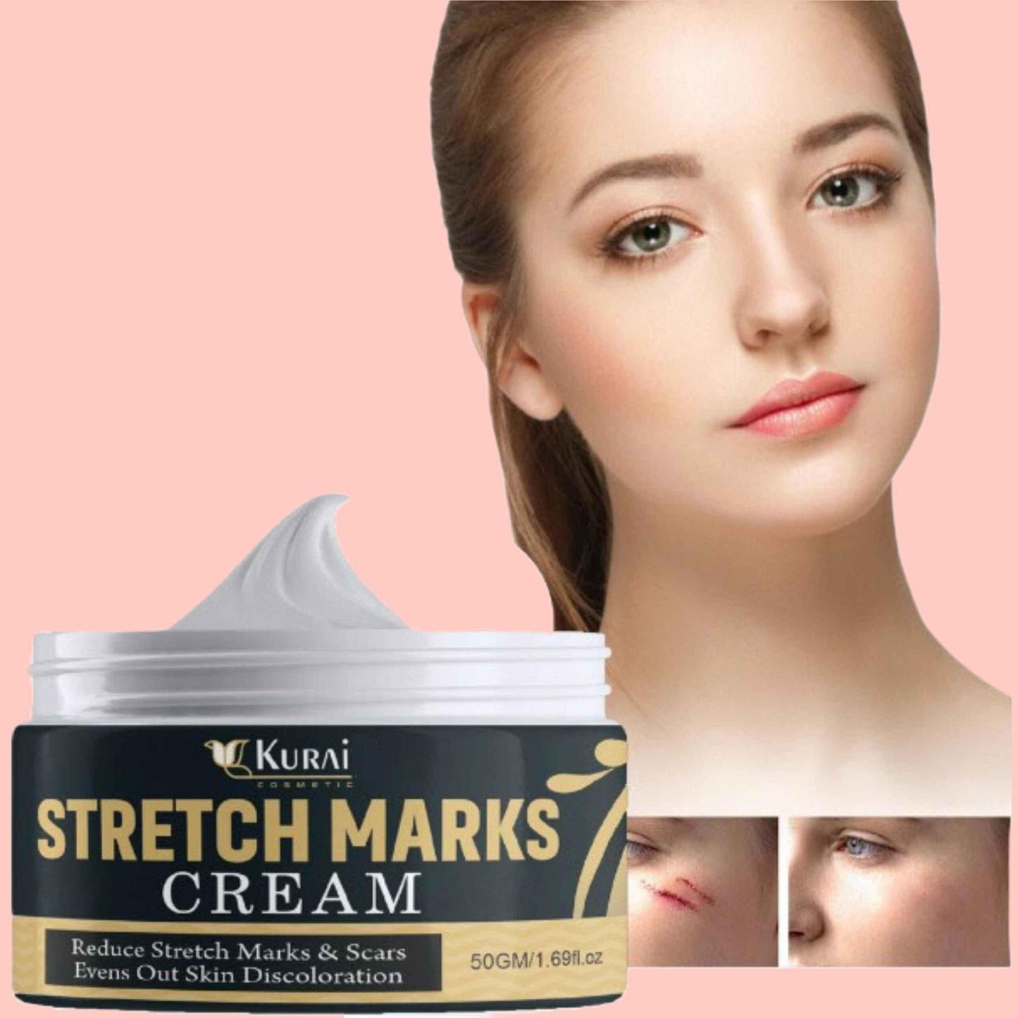 🤩KURAI Pregnancy Scars and Acne Removal Cream🤩