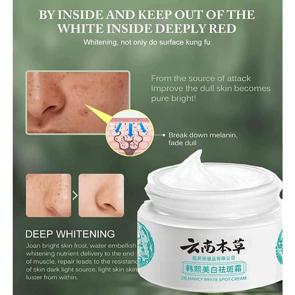 🤩Japanese Melasma Cream [Buy 1 Get 1 Free]🤩