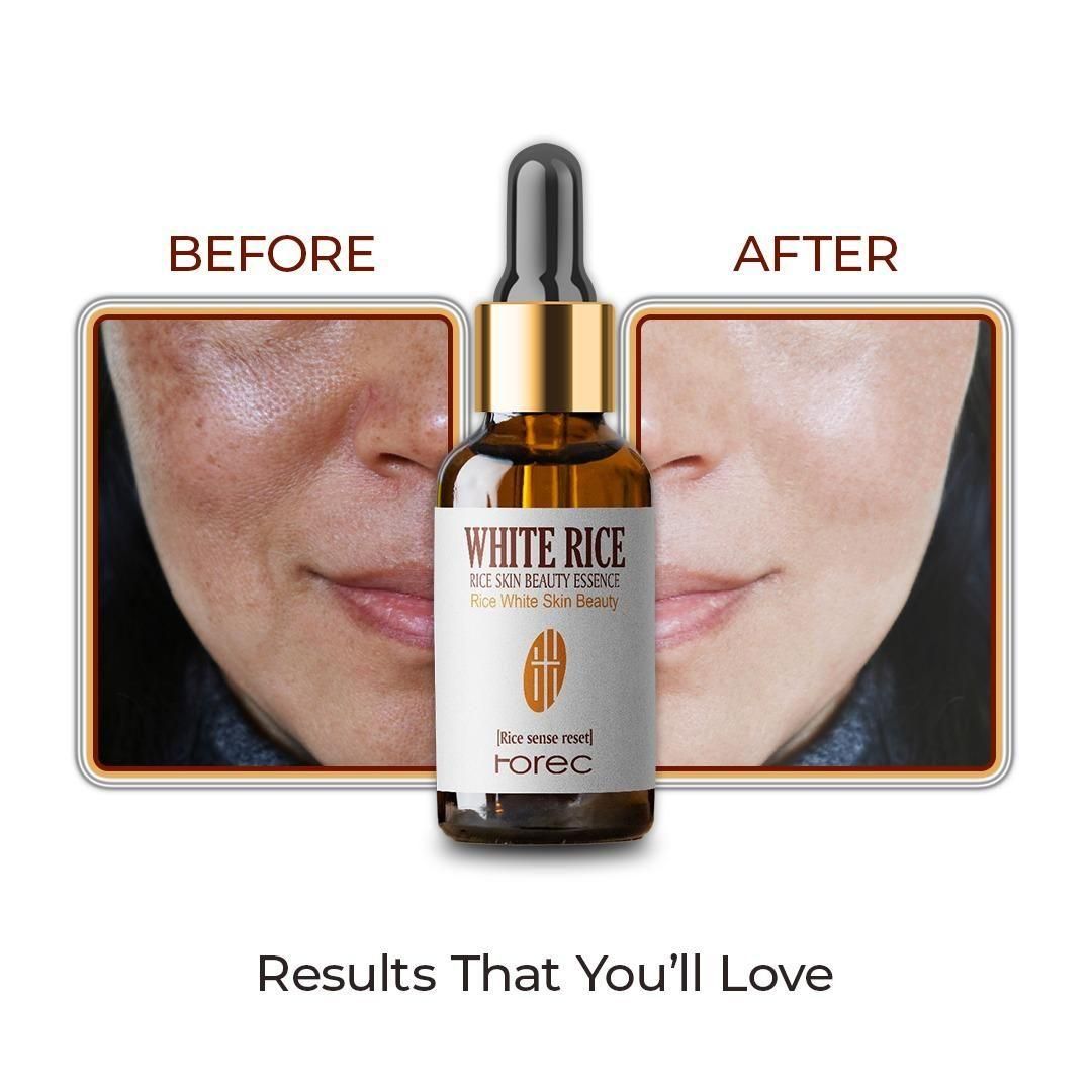 White Rice face serum  (Pack Of 1)