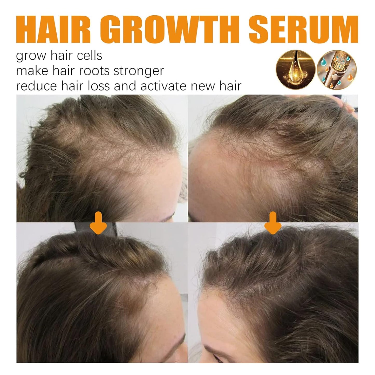 🤩Herbal Biotin Anti Hair Loss and Hair Growth Serum[Buy 1 Get 1 Free]🤩