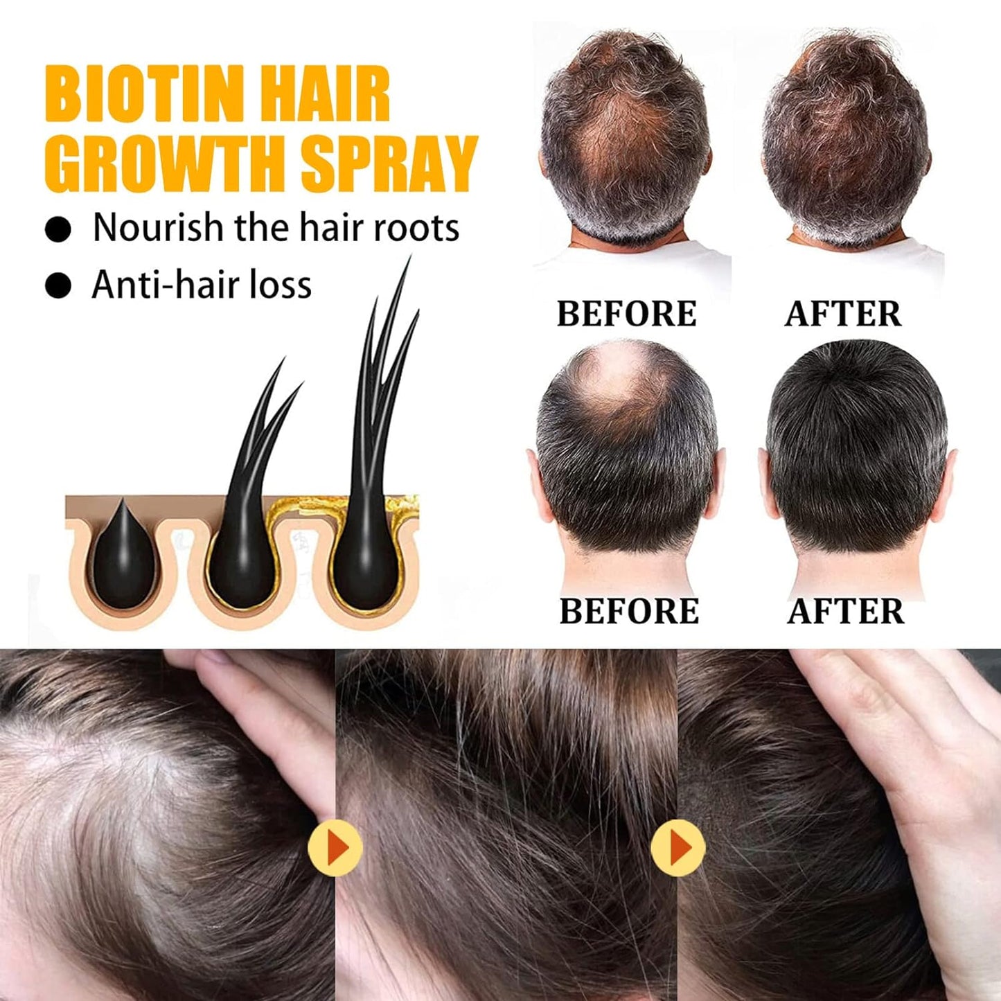 🤩Herbal Biotin Anti Hair Loss and Hair Growth Serum[Buy 1 Get 1 Free]🤩