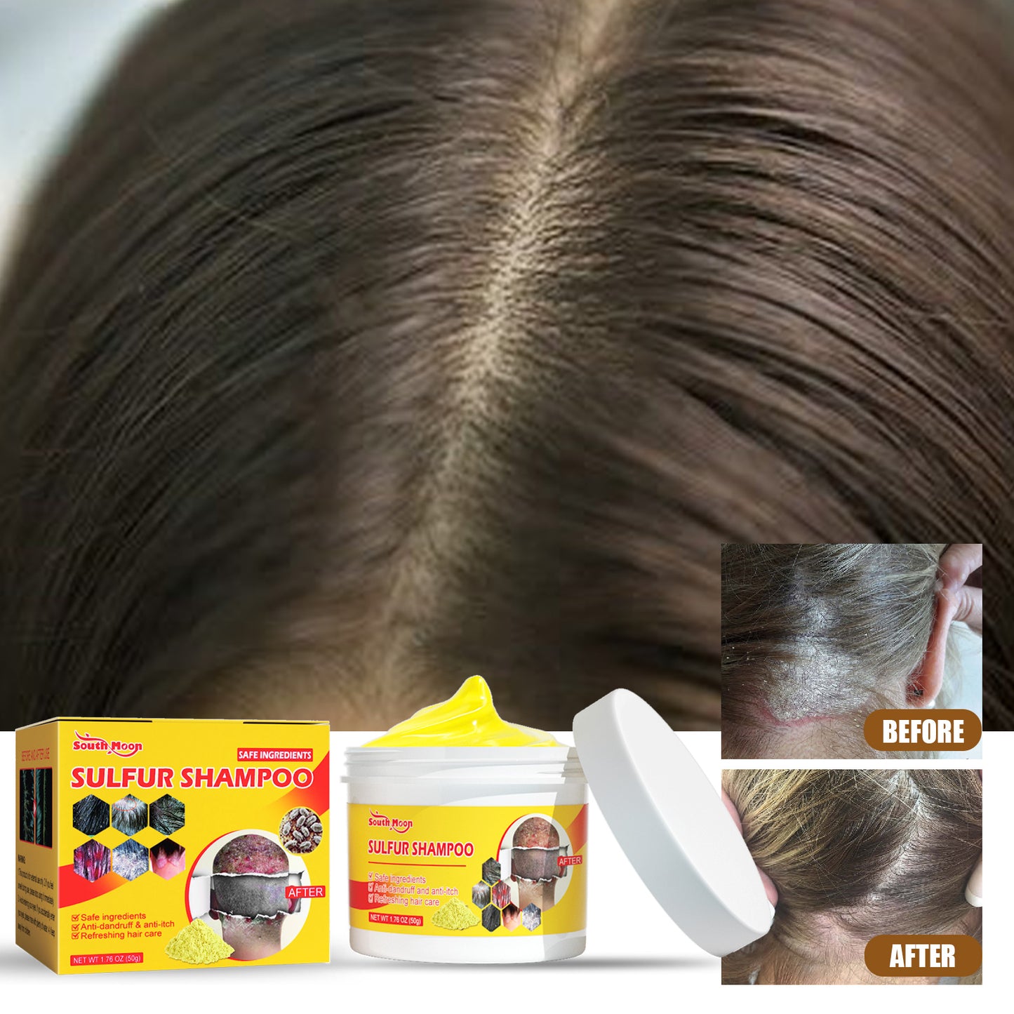 🤩Sulfur Shampoo for Removal of Dandruff and Hair Breakage [Buy 1 Get 1 Free]🤩