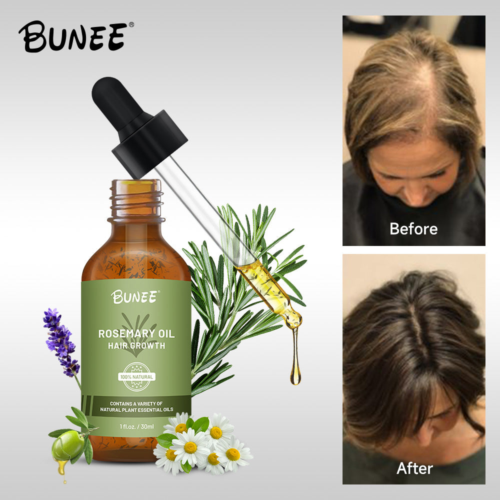 🤩BUNEE Rosemary Hair Growth Serum Oil🤩