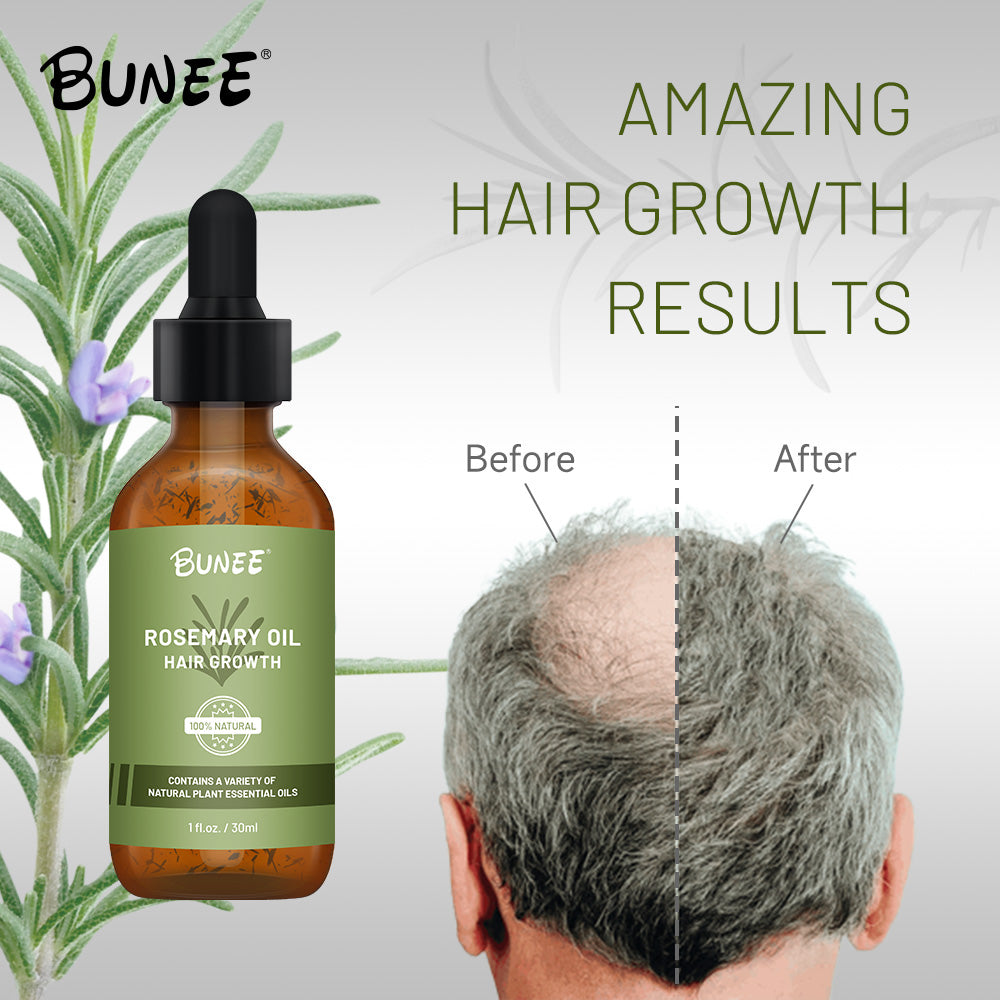 🤩BUNEE Rosemary Hair Growth Serum Oil🤩