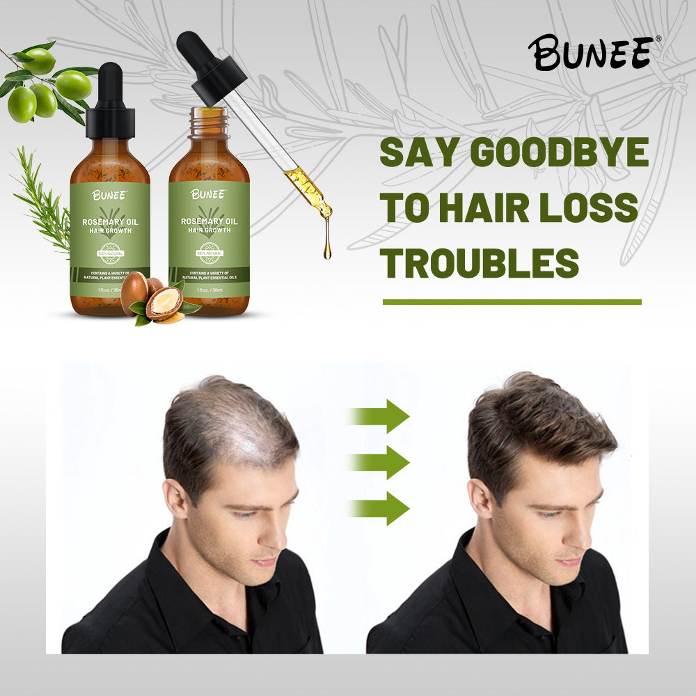 🤩BUNEE Rosemary Hair Growth Serum Oil🤩