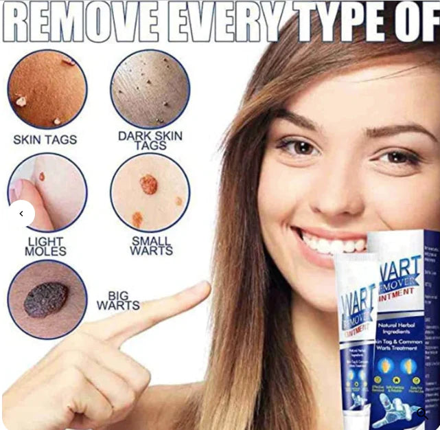 🤩Natural Herbal based Warts Remover Cream [Buy 1 Get 1 free]🤩