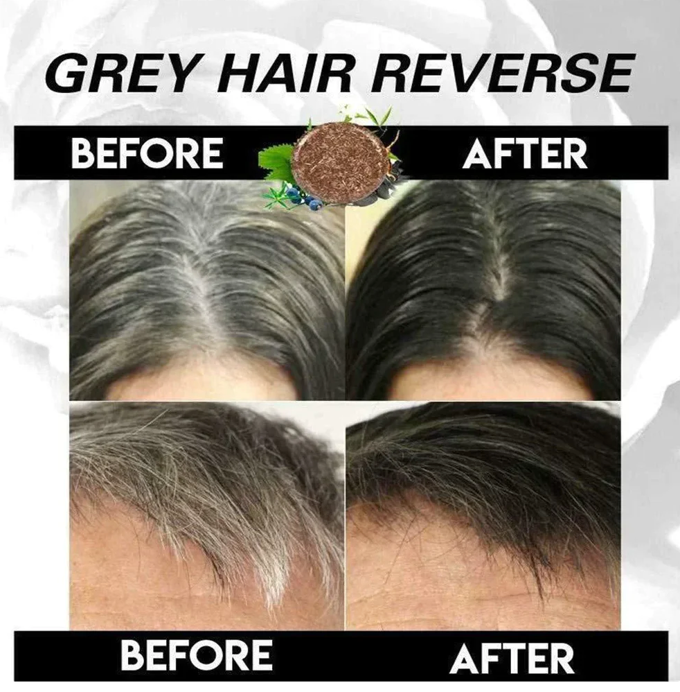 🤩3-IN-1 Black Ayurvedic Hair Dye Shampoo For Grey Hair [🔥Buy 1 Get 1 free🔥]🤩