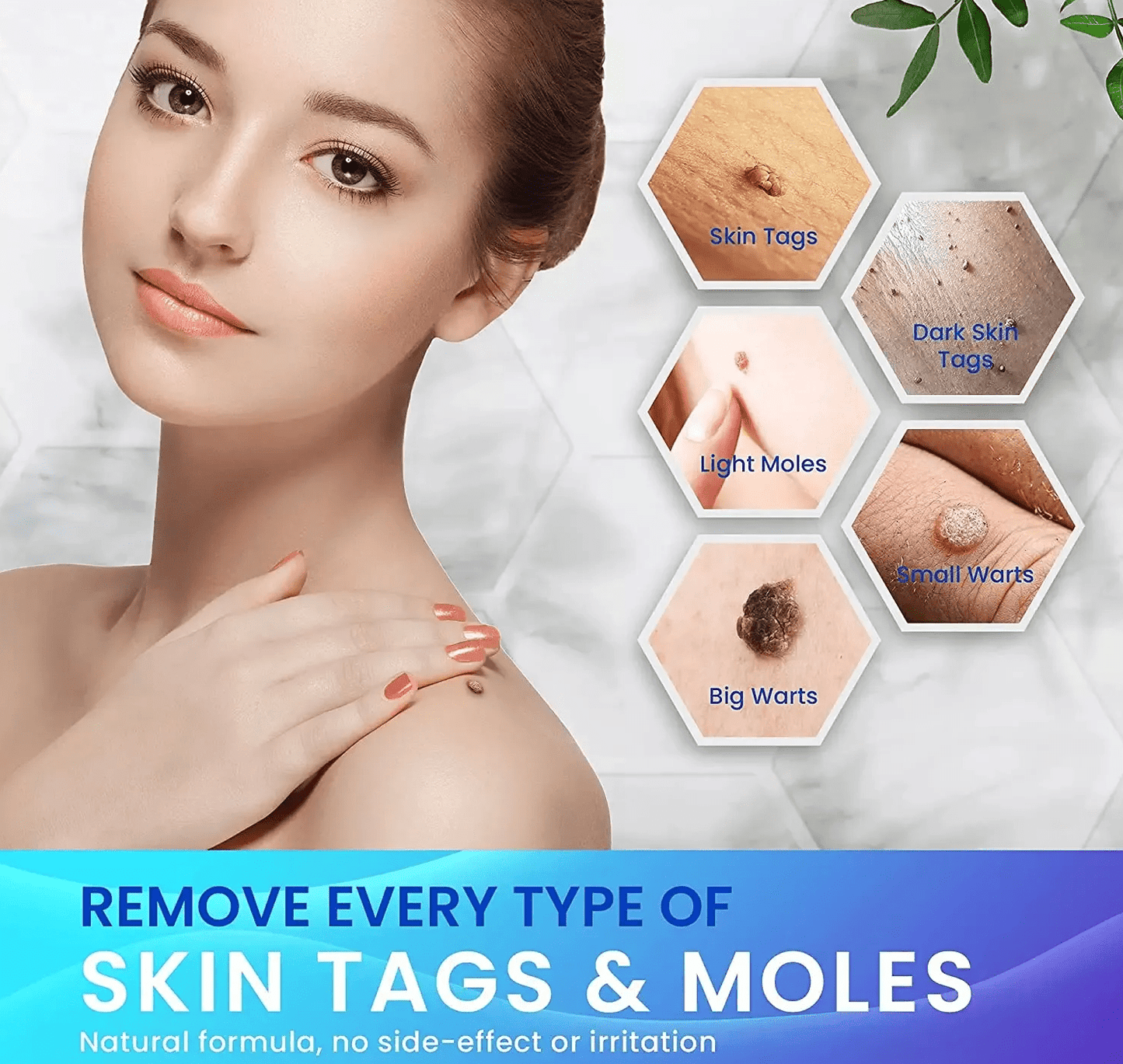 🤩Natural Herbal based Warts Remover Cream [Buy 1 Get 1 free]🤩