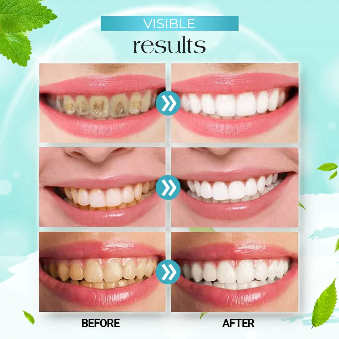 🤩Teeth Whitening Foam Toothpaste [Buy 1 Get 1 Free]🤩